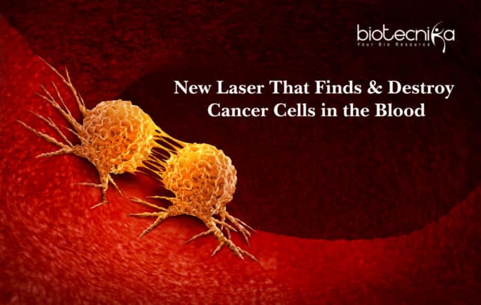 New Laser That Finds & Destroy Cancer Cells in the Blood