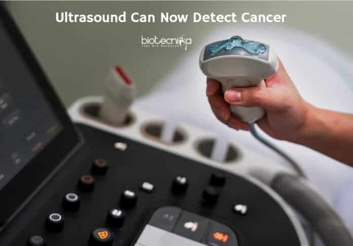 Ultrasound Spots Cancer Early