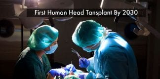 First Human Head Transplant