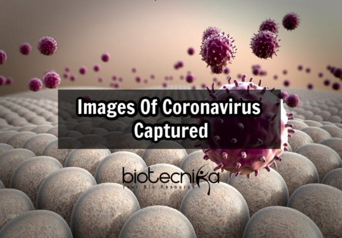 microscope images of coronavirus