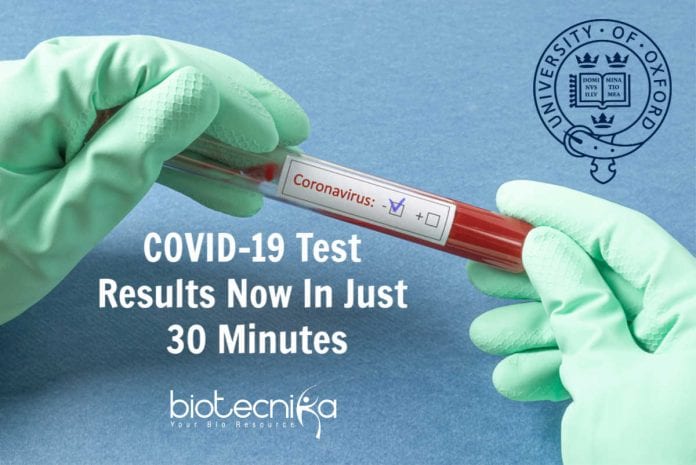 Oxford Scientists Coronavirus Test