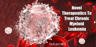 chronic myeloid leukemia