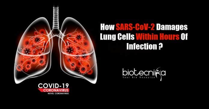 How SARS-CoV-2 Damages Lung Cells