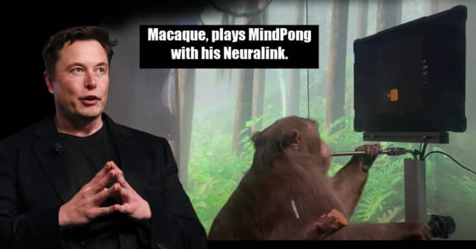 Neuralink Monkey Brain Implant