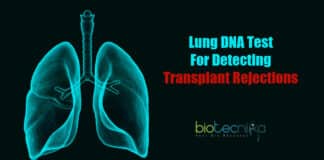 Lung DNA Test